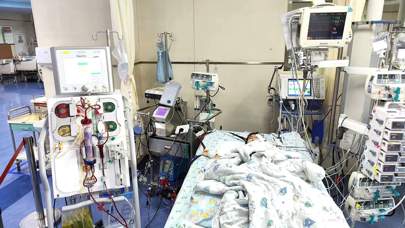 PICU里，上了ECMO+CRRT 的小依依。浙大兒院供圖